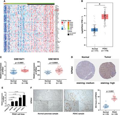 Systematic Characterization of the Clinical Relevance of KPNA4 in Pancreatic Ductal Adenocarcinoma